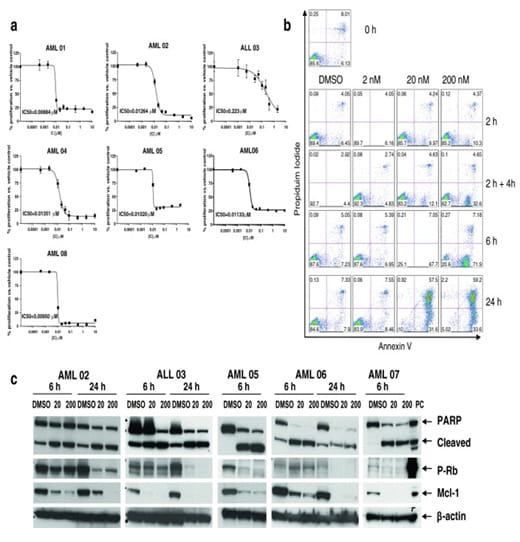 Figure 2 from Gojo et al Cancer Chemother Pharmacol 2013 72: 897-908.  Source: Support of Clinical Trials | University of Maryland Medical Center http://umm.edu/programs/cancer/research/sharedsvc/translationallab/support-of-clinical-trials#ixzz3oNwButTM  University of Maryland Medical Center  Follow us: @UMMC on Twitter | MedCenter on Facebook