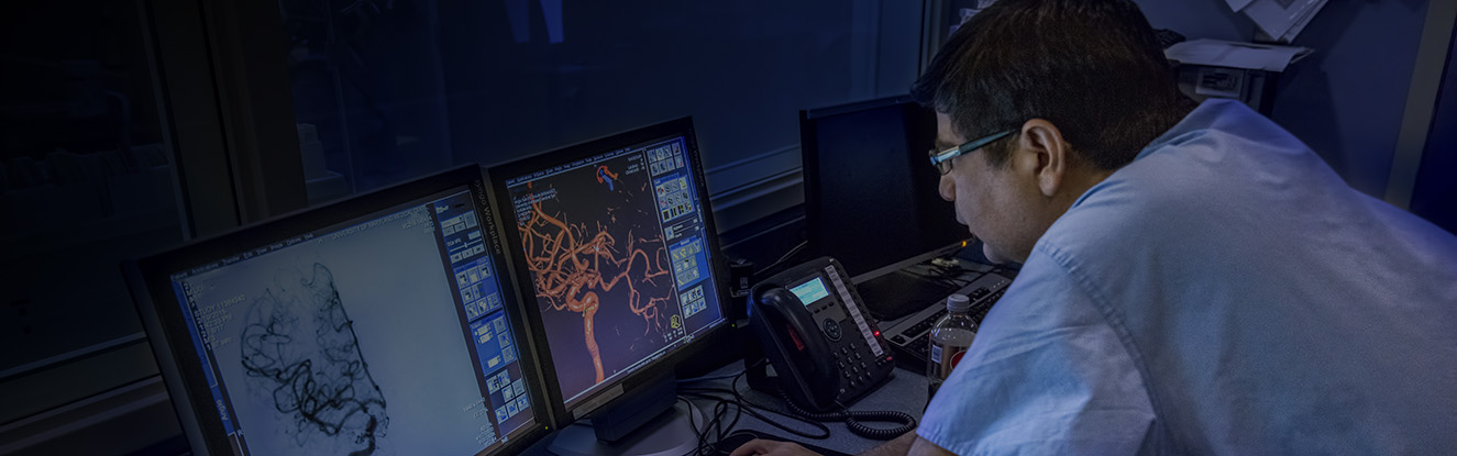 Doctor looking at scans of an aneurysm