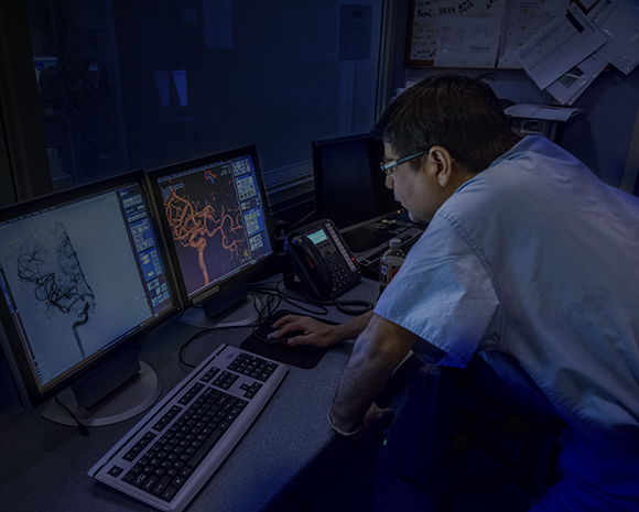 Doctor looking at scans of an aneurysm