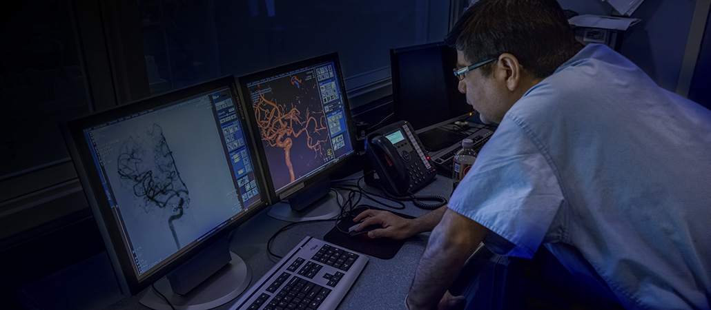 Doctor looking at scans of an aneurysm