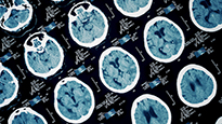 Image of brain scans