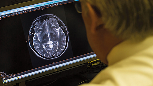 A doctor examines a brain scan