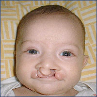 Before photo of Lukas Traynor