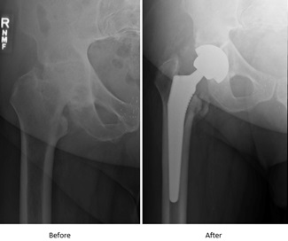 Rudy Jurricks Hip Image