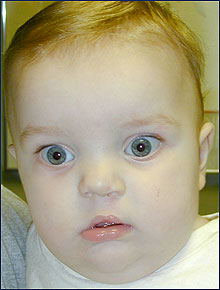 After photo of Ryan Huff