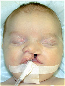 Before picture of Ryan Huff