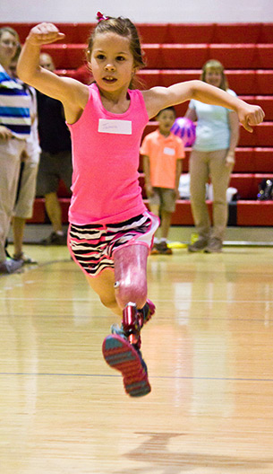 Pediatric amputee runs in a gym