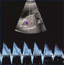 San of part of the blood flow in the heart cycle running backwards